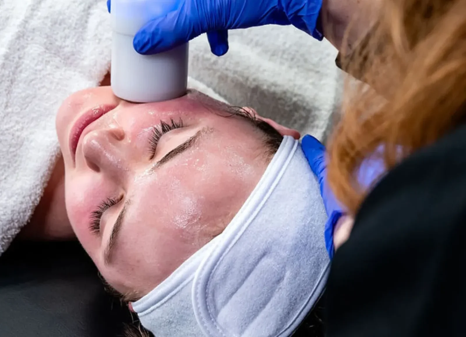 Skincare treatment